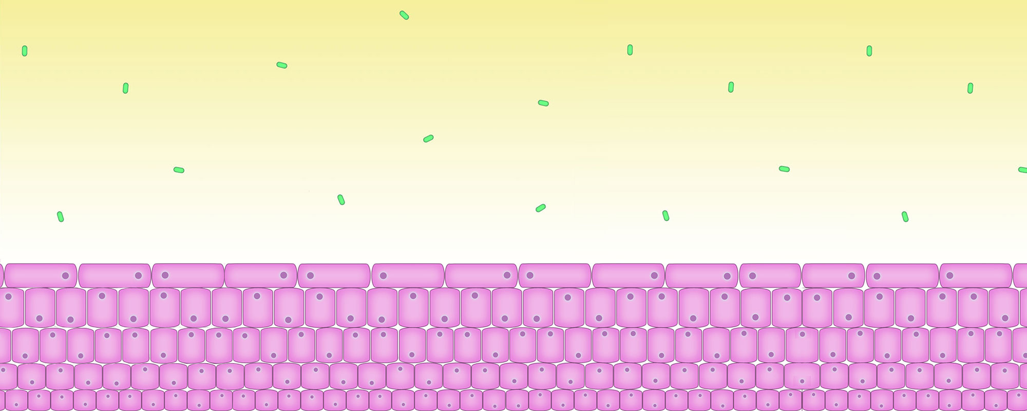 Early phase of a urinary infection