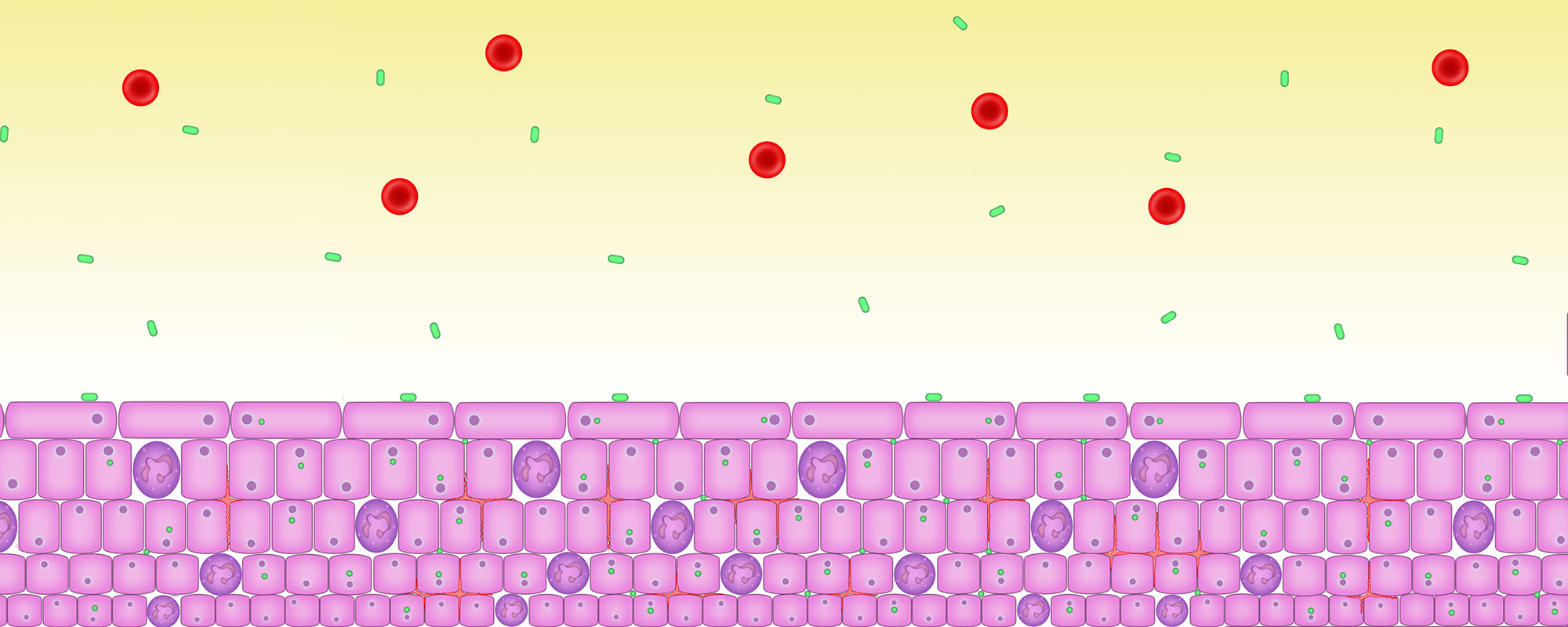 The bladder becomes inflamed