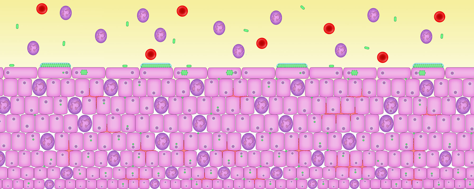 Bacteria that cause disease get into biofilm
