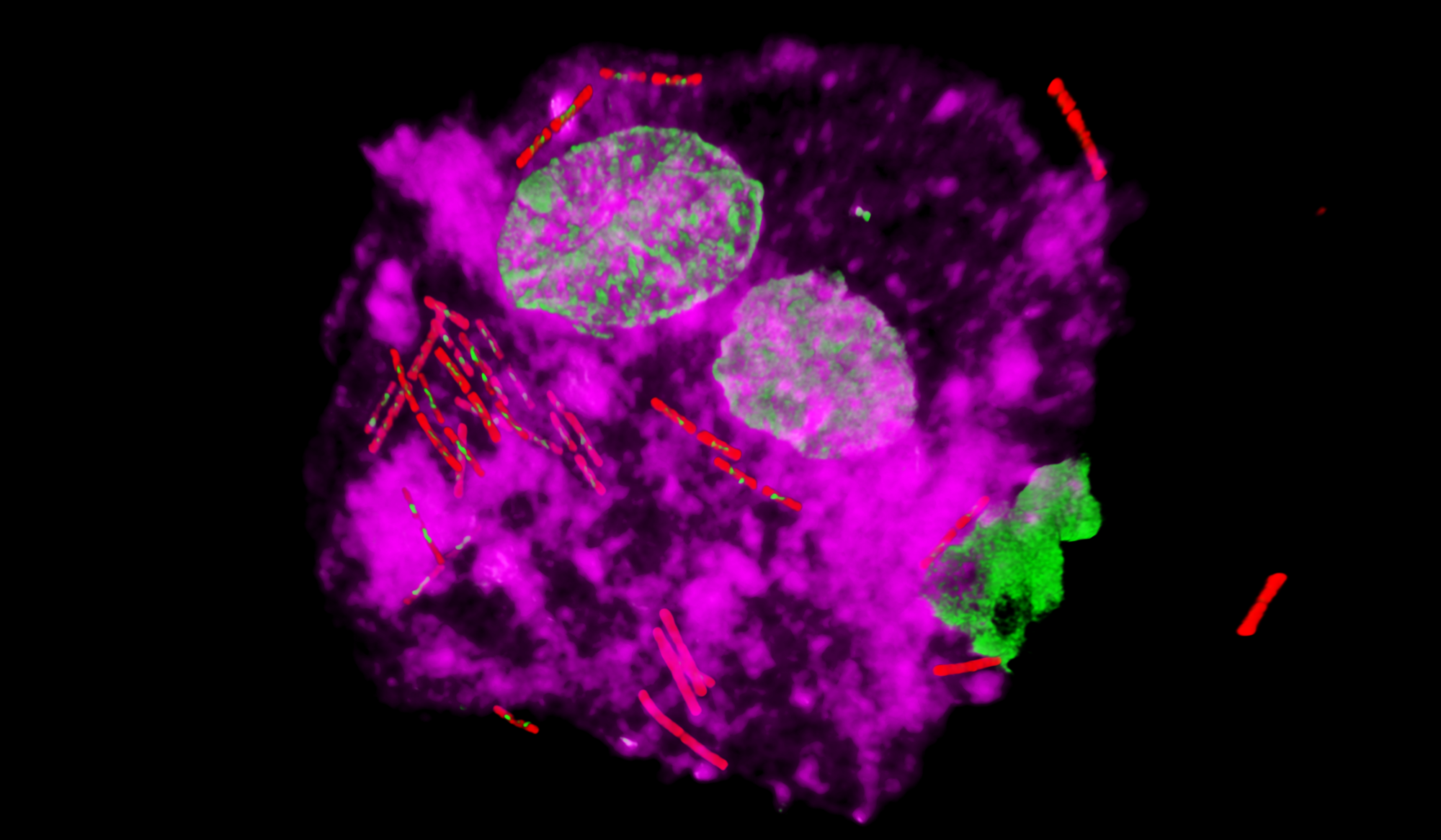 FISH labelled bacteria in urothelial cell