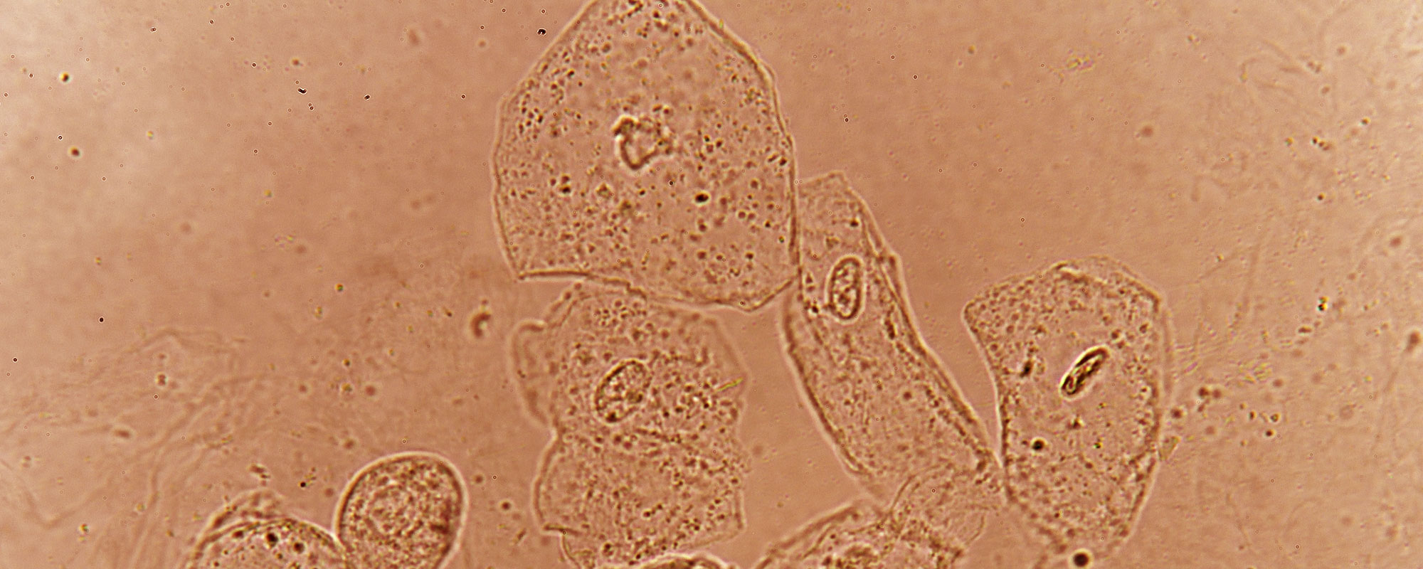 CUTIC Feature image