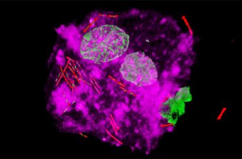 3D super-resolution microscope image from the FISH research project at CCR and shows a urothelial cell (a bladder cell found in patient urine) that has been shed from the bladder lining